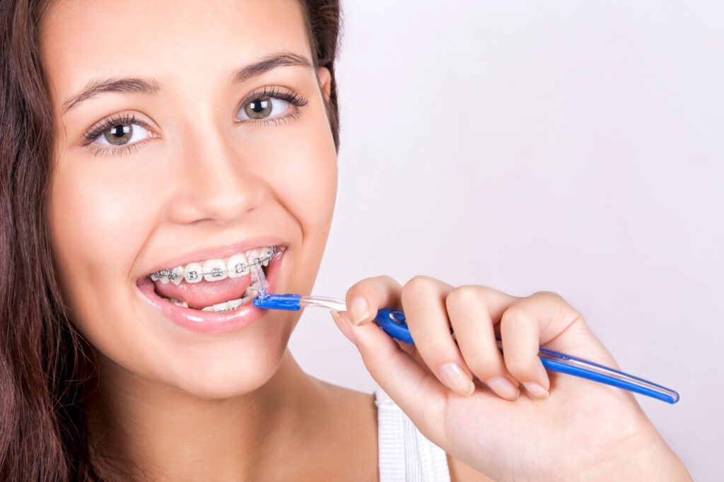 Brushing Tips for Braces Patients