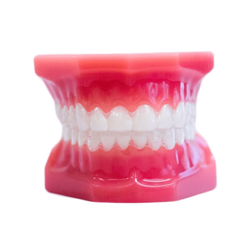 clear aligners on model