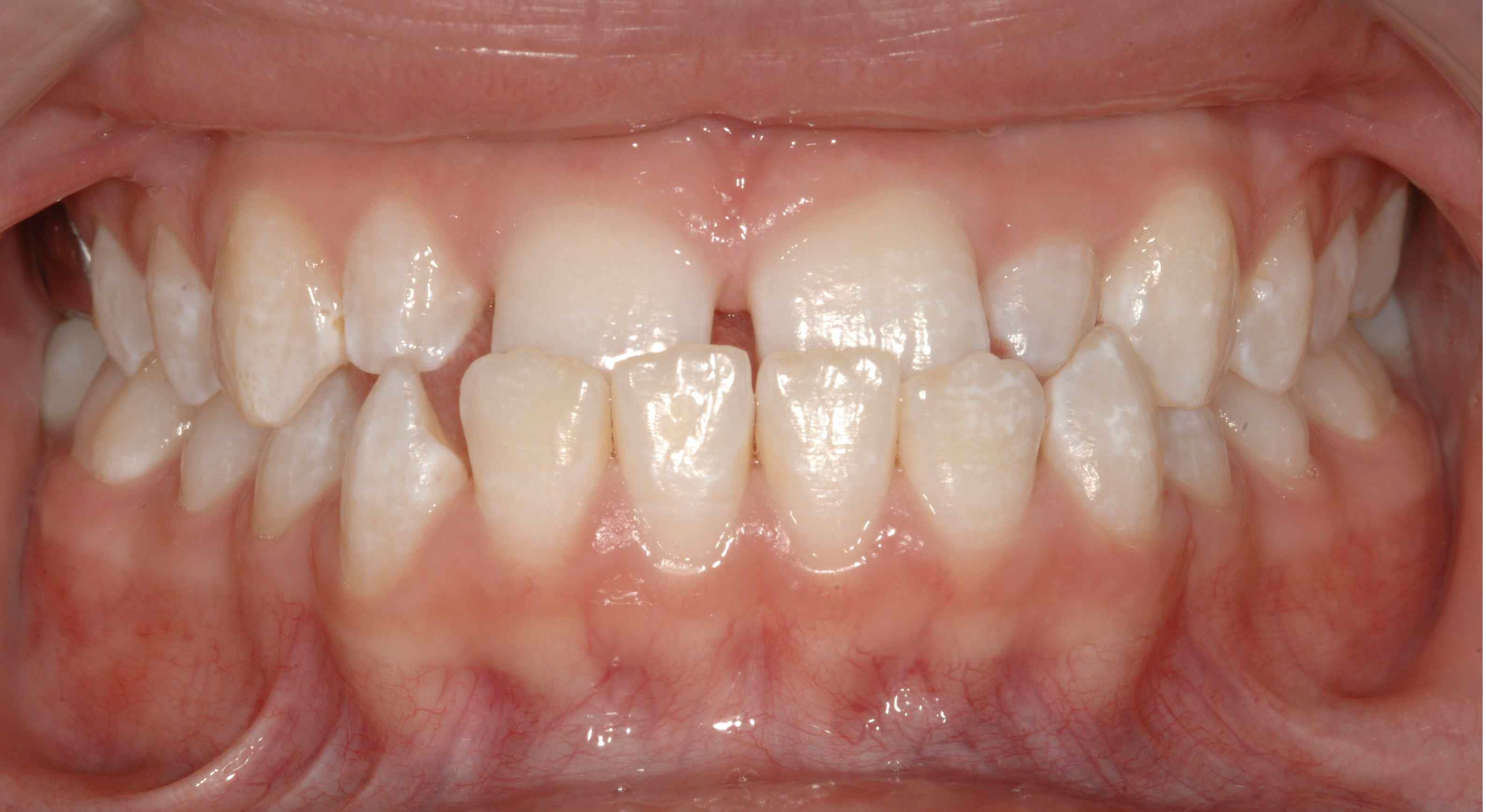 orthodontics wilmette