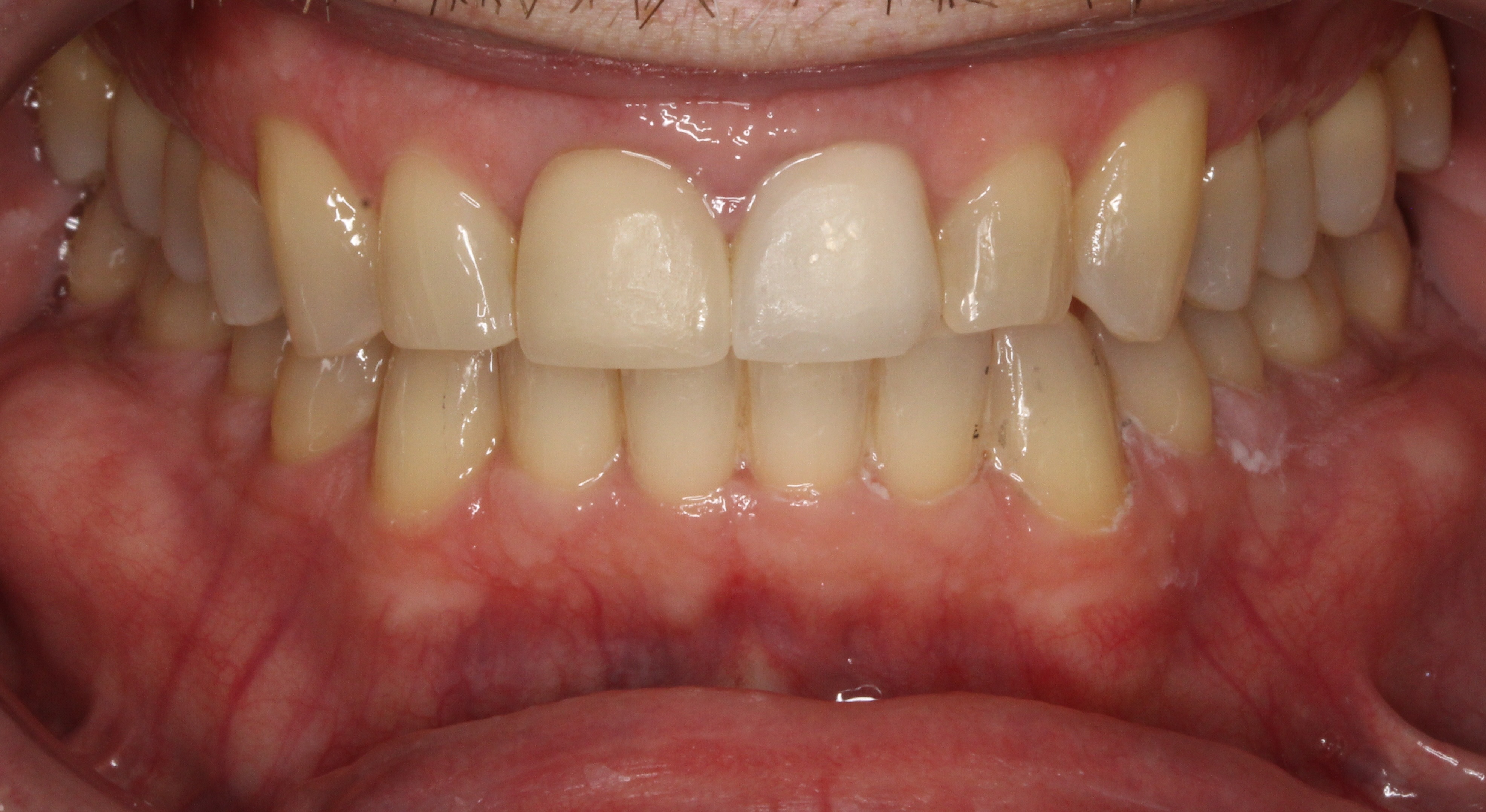 orthodontics wilmette