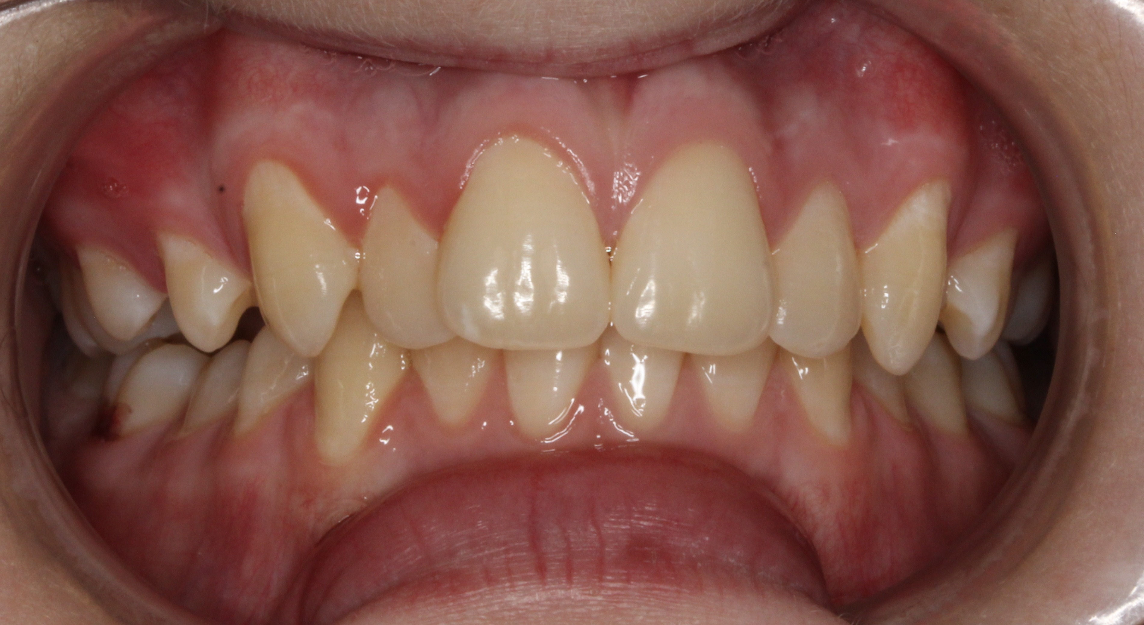 Ross Before Teeth orthodontist glencoe