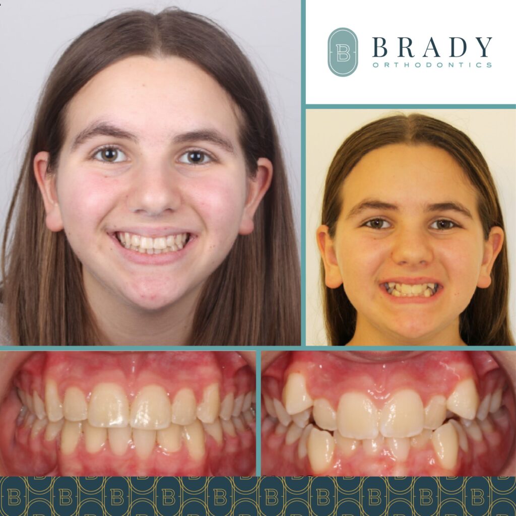 2021-06-28_Brady Ortho_Before and After Templates_CG-02
