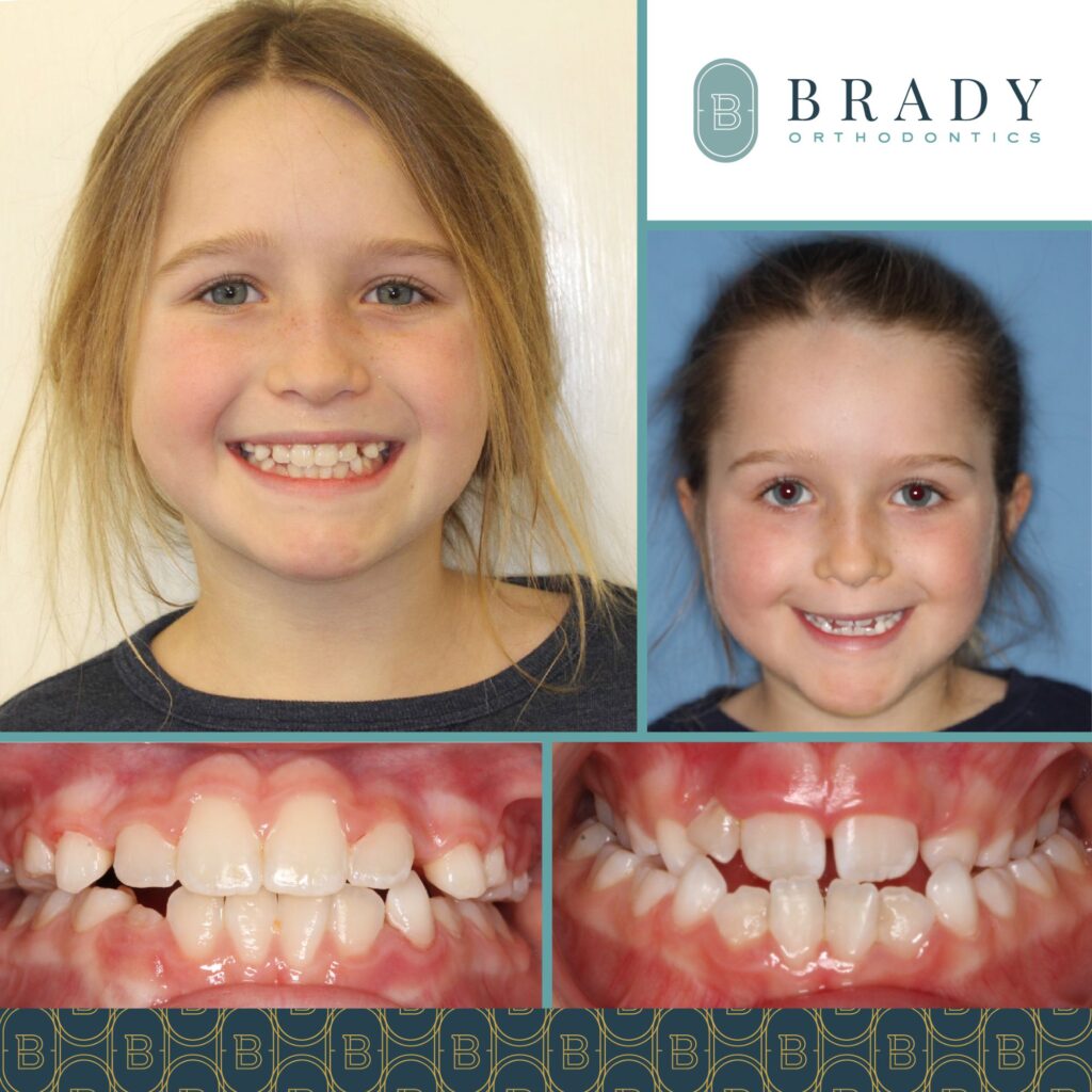 2021-12-09_Brady Ortho_Before and After_TW-01