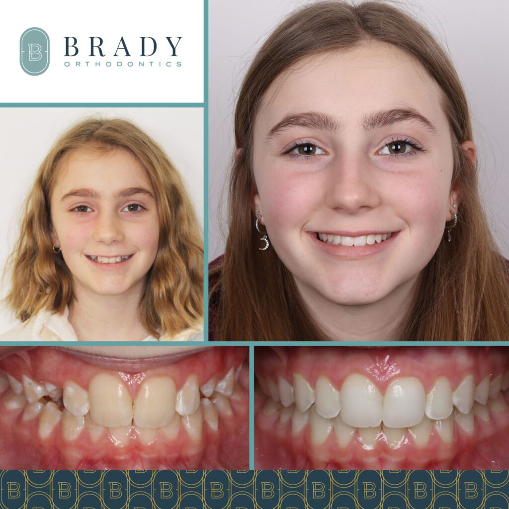 2023-01-20_Brady Ortho_Before and After_CG-01