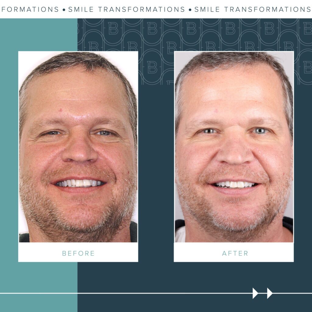2023-07-11_Brady Ortho_Before and After-social post-Steve_BG-02