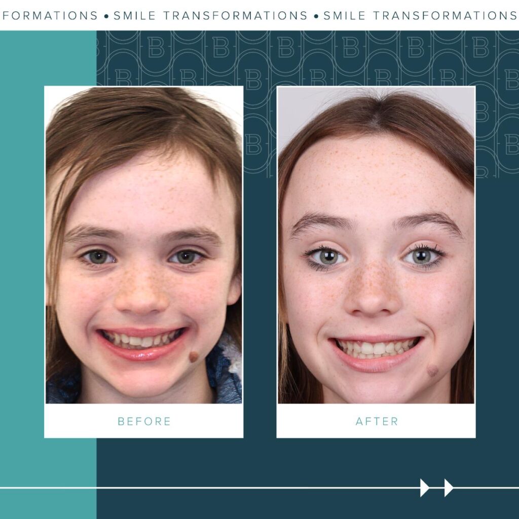 2023-11-13_Brady Ortho_Katherine-Before and After_BG-02