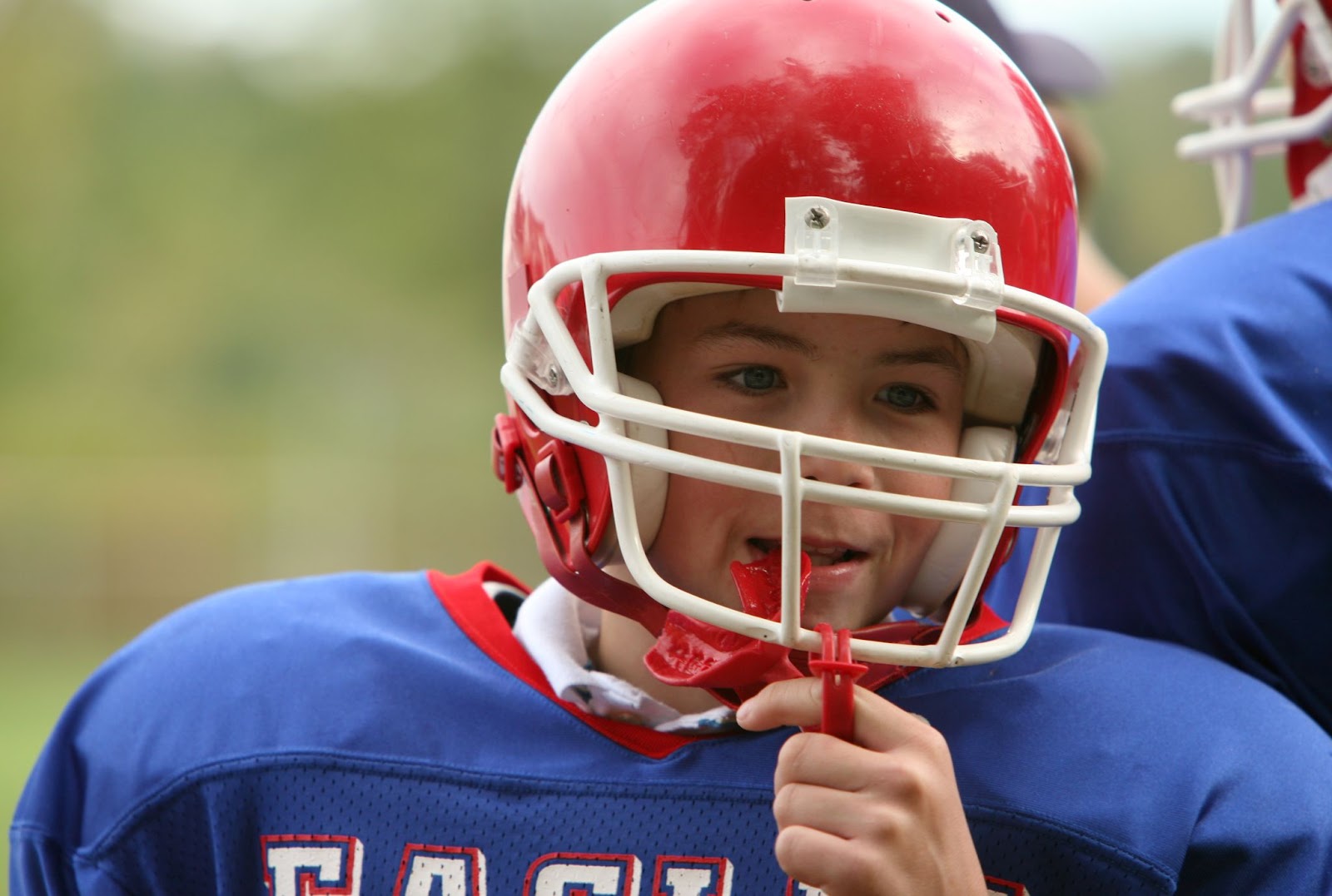 Sports Mouthguards for Braces Every Athlete Should Know About