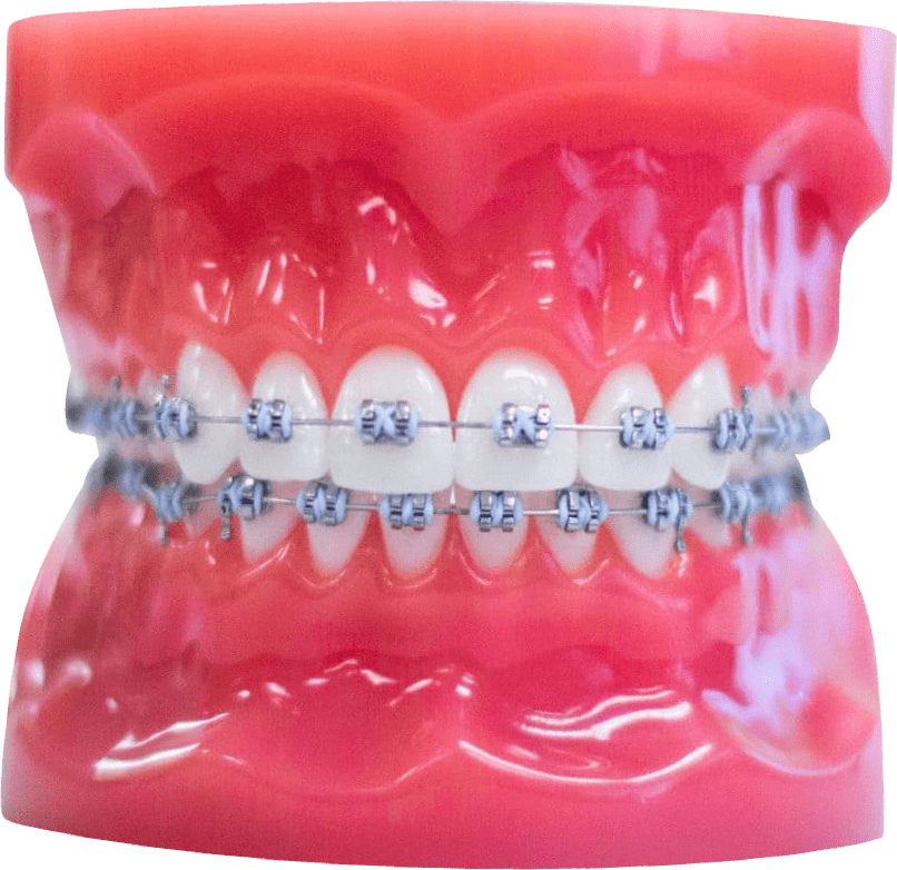 Winnetka Braces